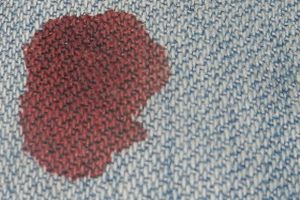 Как удалить пятно от крови с ковра Израиль